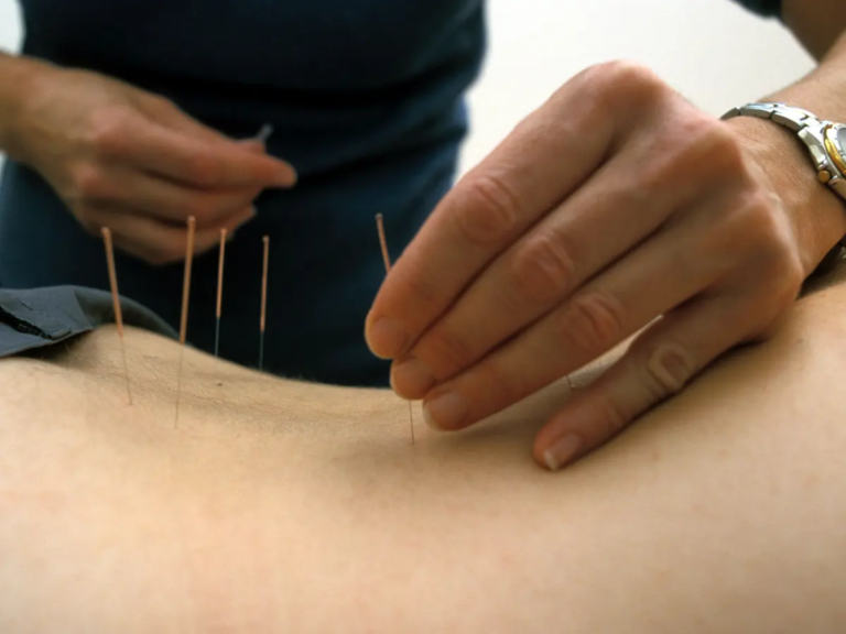 Exploring-Body's-Acupuncture-Responses-111