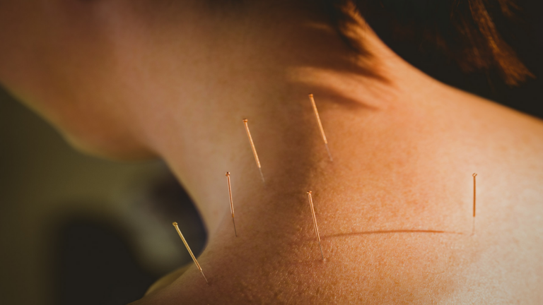 Exploring-Body's-Acupuncture-Responses